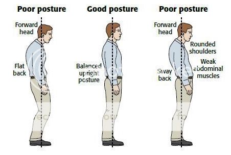 Poor neck posture correction youtube